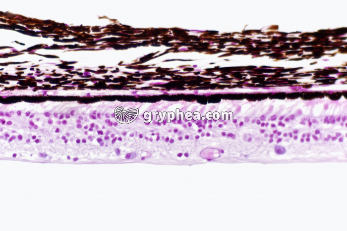 Rétine périphérique x100 - gryphea.org